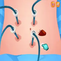 Appendix Surgery Game game screenshot