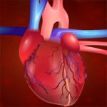 لعبة جراحة القلب المفتوح